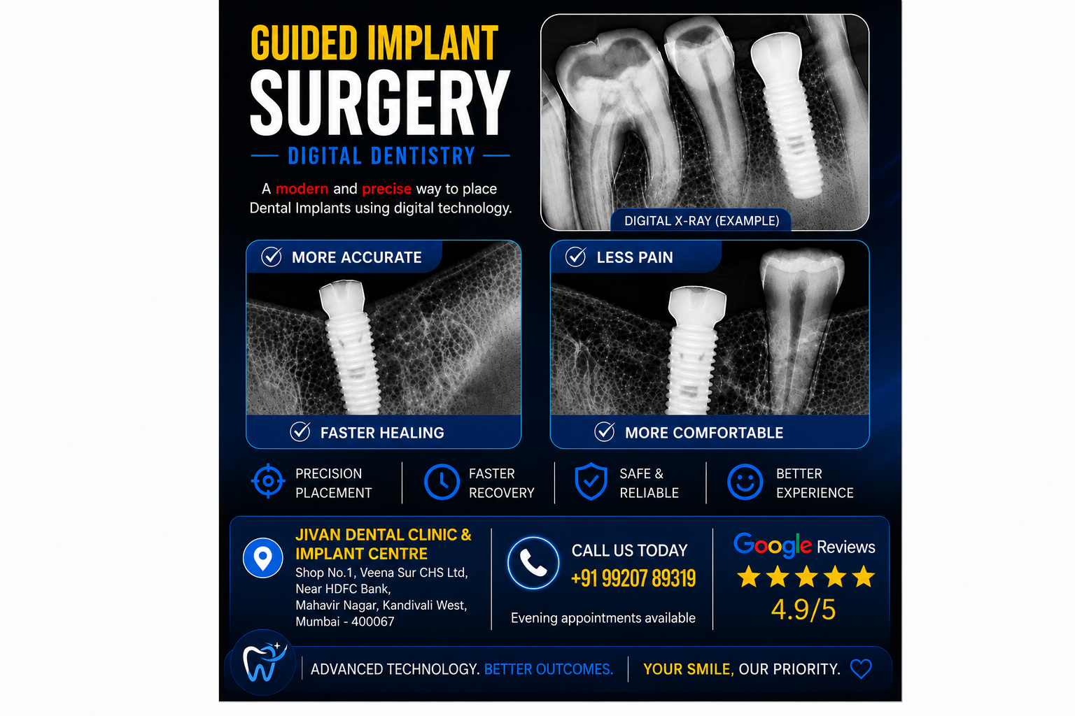 Guided implantology